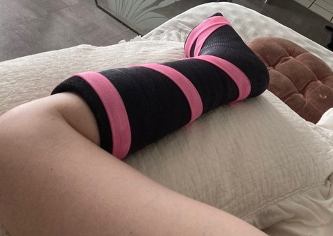 brokenankle93 onlyfans leaked picture 2