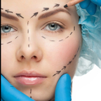 Get Free access to @plasticsurgery (Plastic Surgery Guru) Leak OnlyFans 

 profile picture